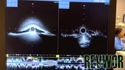 New York cardiologist performs first procedure in US with FDA-cleared imaging tech